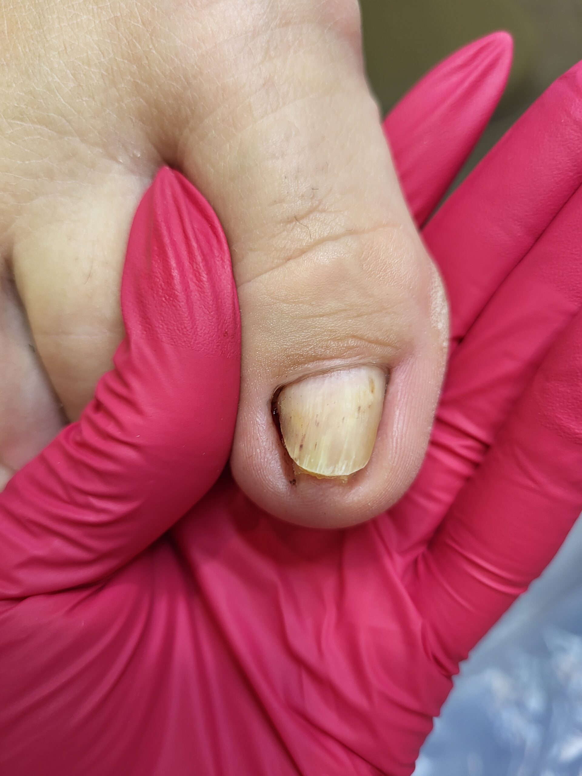 After image